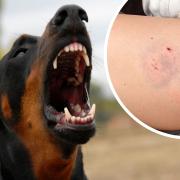 Norfolk and Waveney has seen a big rise in people being treated for dog bites